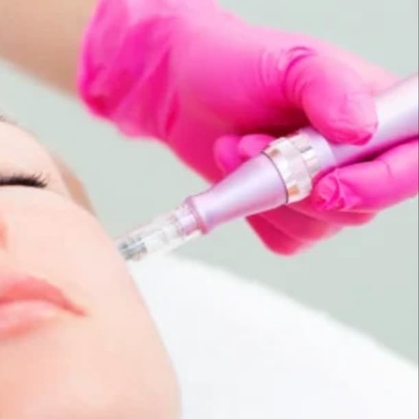 Microneedling - 3 Session Package at Aeri Aesthetics in Conroe, TX